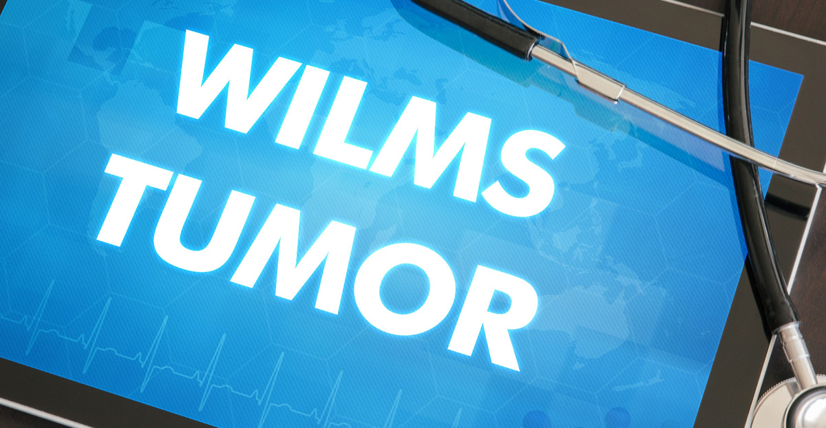 Wilms-tumor-a-genitourinary-tumor-UCI-Pediatric-Urology