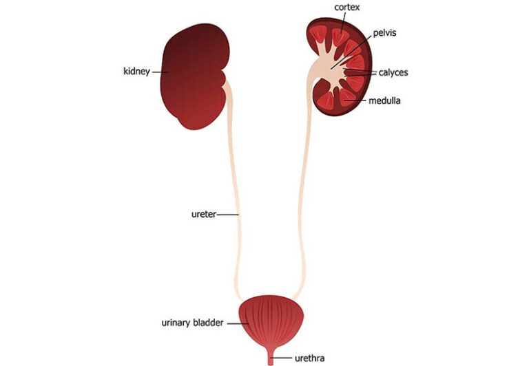 Ureterocele - UCI Pediatric Urology