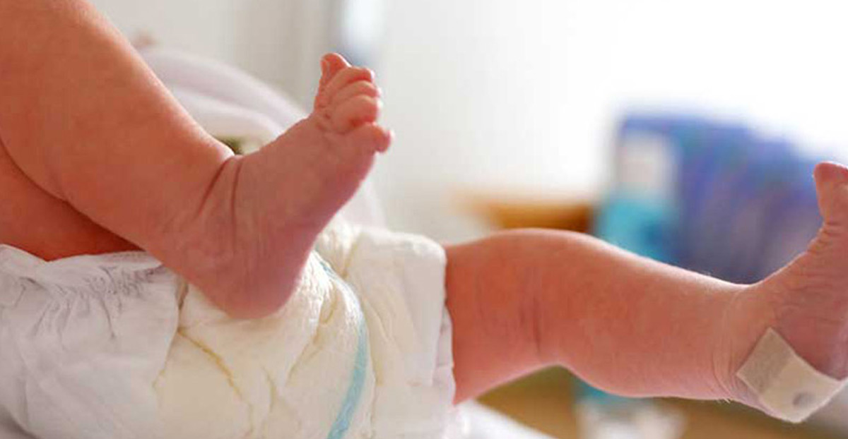 baby-boy-after-birth-with-hypospadias-UCI-Pediatric-Urology