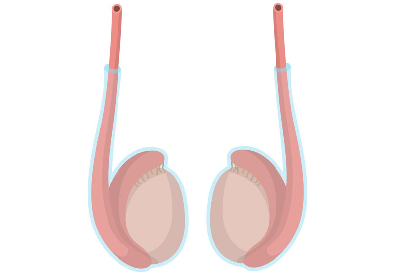 medical-concept-of-scrotum-where-hydrocele-occurs-UCI-Pediatric-Urology