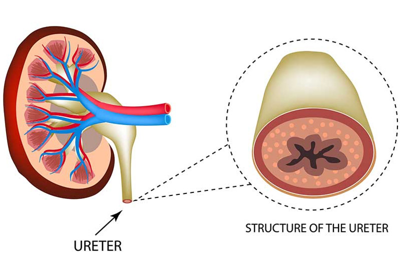 typical-structure-of-the-ureter-as-opposed-to-ureteral-duplication-UCI-Pediatric-Urology