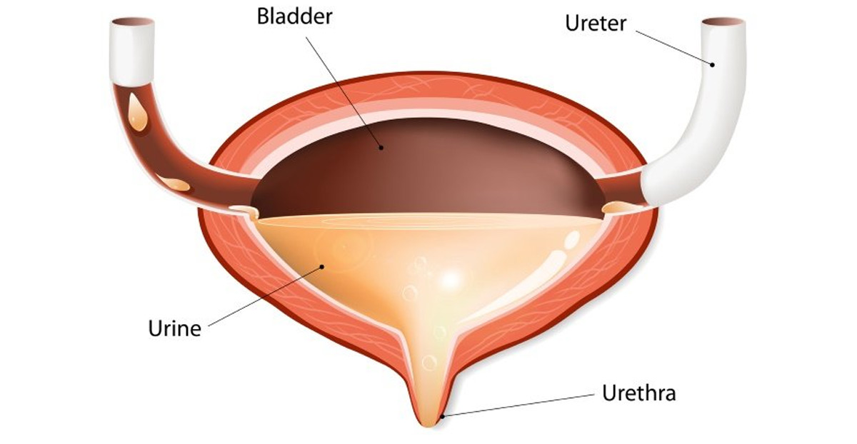 biofeedback-is-used-to-train-bladder-muscles-UCI-Pediatric-Urology